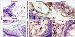 CD34 Antibody in Immunohistochemistry (IHC)