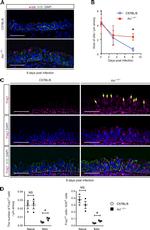FOXJ1 Antibody in Immunohistochemistry, Immunocytochemistry (IHC, ICC/IF)