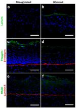 LOR Antibody in Immunohistochemistry, Immunocytochemistry (IHC, ICC/IF)