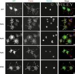 GFP Antibody in Immunocytochemistry (ICC/IF)