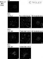 GFP Antibody in Immunocytochemistry (ICC/IF)