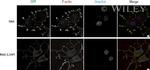 GFP Antibody in Immunocytochemistry (ICC/IF)