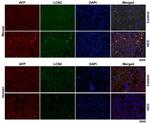 AFP Antibody in Immunohistochemistry, Immunocytochemistry (IHC, ICC/IF)