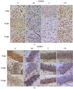TIMP3 Antibody in Immunohistochemistry (IHC)