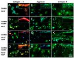 Collagen X Antibody in Immunohistochemistry, Immunocytochemistry (IHC, ICC/IF)