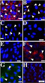 VWF Antibody in Proximity Ligation Assay (PLA) (PLA)