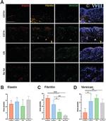 Versican Antibody in Immunohistochemistry, Immunocytochemistry (IHC, ICC/IF)