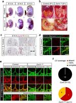 LYVE1 Antibody in Immunohistochemistry, Immunocytochemistry (IHC, ICC/IF)