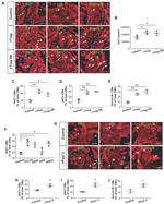 Ki-67 Antibody in Immunocytochemistry (ICC/IF)
