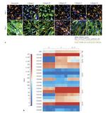 Collagen IV Antibody in Immunocytochemistry (ICC/IF)