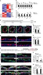 FOXJ1 Antibody in Immunohistochemistry, Immunocytochemistry (IHC, ICC/IF)