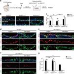 FOXJ1 Antibody in Immunohistochemistry, Immunocytochemistry (IHC, ICC/IF)