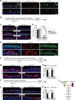 FOXJ1 Antibody in Immunohistochemistry, Immunocytochemistry (IHC, ICC/IF)