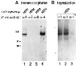 ErbB4 Antibody in Western Blot (WB)