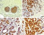 EBP50 Antibody in Immunohistochemistry (IHC)