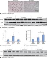 Thrombospondin 1 Antibody in Western Blot (WB)