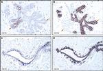 Cytokeratin 15 Antibody in Immunohistochemistry (IHC)