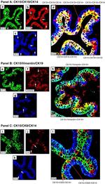 Cytokeratin 14 Antibody in Immunohistochemistry (IHC)