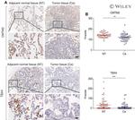 CMTM2 Antibody in Immunohistochemistry (IHC)