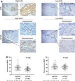 CD105 Antibody in Immunohistochemistry (IHC)