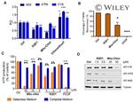 MT-ND6 Antibody in Western Blot (WB)