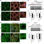 GDF9 Antibody in Immunohistochemistry, Immunocytochemistry (IHC, ICC/IF)