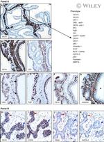 Cytokeratin 19 Antibody in Immunohistochemistry (IHC)