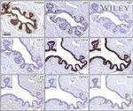 Cytokeratin 17 Antibody in Immunohistochemistry (IHC)