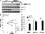 Phospho-VE-cadherin (Tyr731) Antibody in Western Blot (WB)