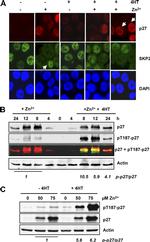 Phospho-p27 Kip1 (Thr187) Antibody in Western Blot (WB)