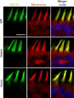 PMCA2 ATPase Antibody in Immunohistochemistry, Immunocytochemistry (IHC, ICC/IF)