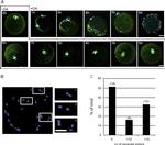 alpha Tubulin Antibody in Immunohistochemistry, Immunocytochemistry (IHC, ICC/IF)