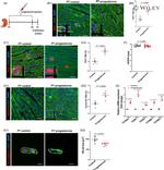 Cardiac Troponin T Antibody in Immunohistochemistry, Immunohistochemistry (PFA fixed), Immunocytochemistry (IHC, IHC (PFA), ICC/IF)