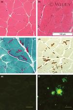 SERCA1 ATPase Antibody in Immunohistochemistry (IHC)