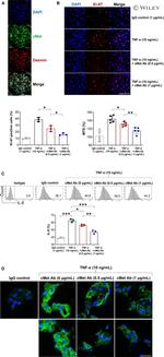 Desmin Antibody in Immunohistochemistry, Immunocytochemistry (IHC, ICC/IF)