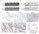 COL11A1 Antibody in Immunohistochemistry (IHC)