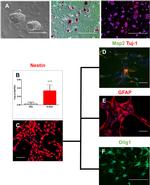 Nestin Antibody in Immunocytochemistry (ICC/IF)