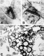 Connexin 43 Antibody in Immunohistochemistry (IHC)