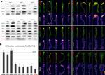 LARP1 Antibody in Western Blot, Immunocytochemistry (WB, ICC/IF)