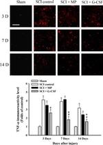 TNF alpha Polyclonal Antibody