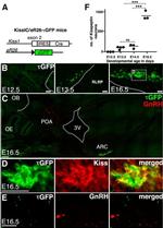 GnRH1 Antibody in Immunohistochemistry, Immunocytochemistry (IHC, ICC/IF)