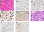 Creatine Kinase MM Antibody in Immunohistochemistry (IHC)