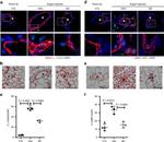Alpha-Smooth Muscle Actin Antibody in Immunohistochemistry, Immunocytochemistry (IHC, ICC/IF)