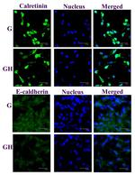 Calretinin Antibody in Immunocytochemistry (ICC/IF)