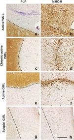 HLA-DR Antibody in Immunohistochemistry (IHC)