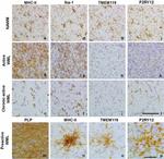 HLA-DR Antibody in Immunohistochemistry (IHC)