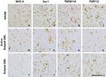 HLA-DR Antibody in Immunohistochemistry (IHC)