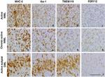 HLA-DR Antibody in Immunohistochemistry (IHC)