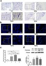 c-Kit Antibody in Immunohistochemistry (IHC)