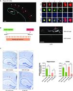 6x-His Tag (C-term) Antibody in Immunocytochemistry (ICC/IF)